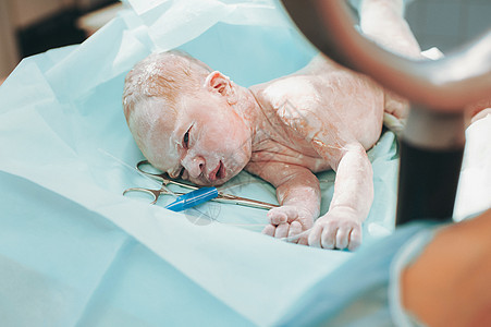 在医院出生后 母亲和新生儿的皮肤与皮肤相接图片