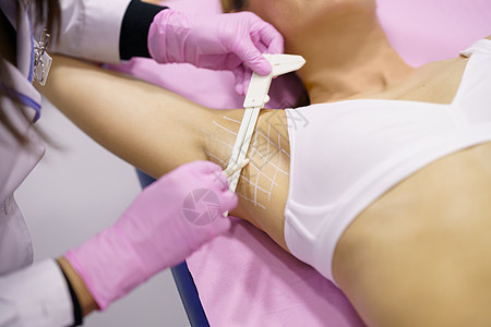 医生在她的病人的腹部上画画 那里是治疗过激中毒的地区毒素出汗中年腋窝注射器成人护理注射沙龙女士图片