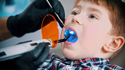 一个在牙科做牙齿的小男孩-将带有蓝光的光聚合物灯放入嘴中以设置密封图片