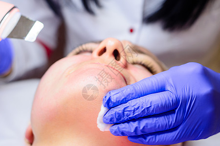 美容师用微振动器超声波进行面部运动并去除被磨蚀的旧皮肤色素斑化妆品药品女士皮肤科角化手套程序帽子黑头图片
