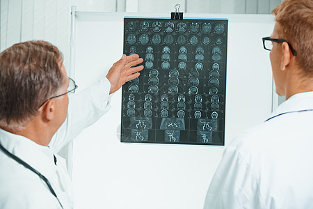 医生们正在医院分析MRI图像图片