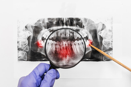 医生的手戴着防护性医用手套 通过白色背景上的放大镜检查牙齿的 X 光照片图片