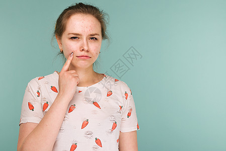 少女摸着她的脸 寻找的肖像瘢痕治疗化妆品青春期皮肤女孩前额水痘缺陷青少年图片