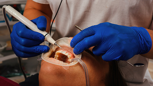 牙医用超声波检查取出牙科病人的防晒油 将嘴唇和口香糖隔离开来手术保健员办公室矫正外科无菌器械保健诊所手套超声波图片