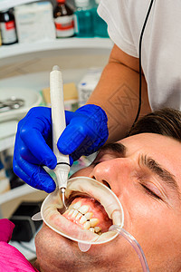 牙科实践 牙医在超声波的帮助下去除牙齿上的结石和硬斑块 患者口腔内有牵引器和唾液喷射器临床喷砂机矫正医生团队望远镜助理乐器药品检图片