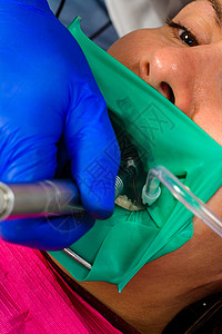 牙医用现代方法治疗牙齿 使用橡胶大坝和不育的牙齿治疗围堰药品乐器床单疼痛运河牙科中心医生口服图片