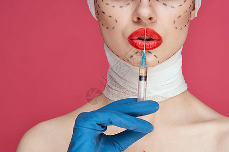 穿着蓝手套针筒的美女 在脸部举起式工作室生活方式上的轮廓塑料程序病人治疗护理医院手术美容师医生嘴唇图片
