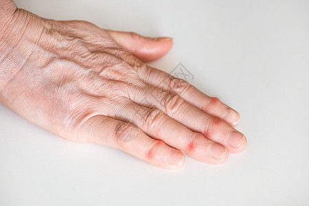 老年男子用白种手指着老男人生病的女性手指症状药品压力伤害女士医生疾病诊断诊所皮肤图片