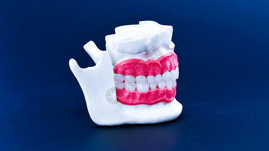 带有牙齿和口香糖的人体下巴解剖模型健康矫正假牙口腔科牙医实验室治疗牙科美白药品图片