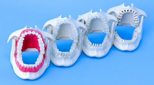 牙医正畸牙齿模型口腔科展示外科诊所医生牙龈塑料教学治疗科学图片