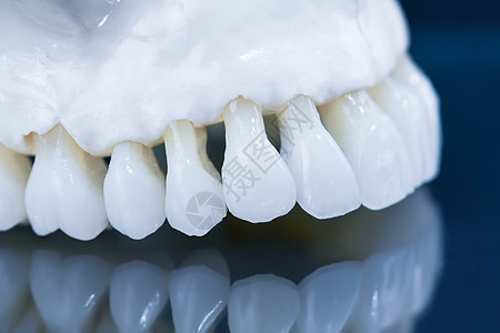 上层人类下巴模型 玻璃上反射药品牙科口服美白牙齿牙医王冠技术矫正口腔科图片