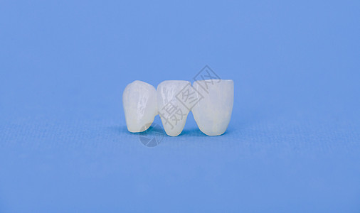 免费金属陶瓷牙冠牙医诊所治疗假肢单板牙科反射宏观制品皇后图片