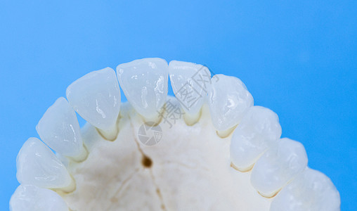 长着牙齿的上人下巴假牙手术口腔科技术医生外科健康解剖学矫正塑料图片