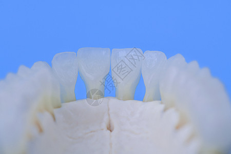 具有牙齿解剖模型的低下人下下下巴健康治疗口腔科手术假肢卫生医生矫正诊所口服图片