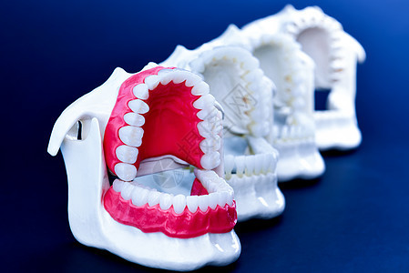 牙医正畸牙齿模型手术诊所工具技术展示牙科矫正教学卫生治疗图片