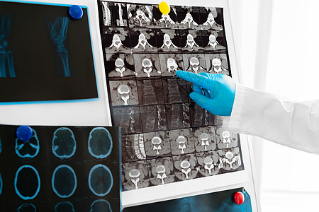 医生握着头骨扫描仪的手技术员专家x射线医师神经学家扫描放射科检查核磁共振男人图片