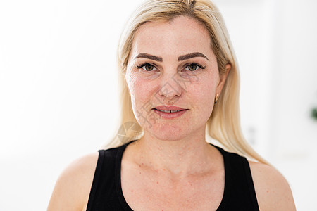 脸部和颈部的生物再生化 与衰老和皮肤色素的征兆作斗争老化美容女性病人物质紫外线皱纹夹头女士注射图片