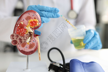 尿液测试封闭的泌尿医生桌上人类立立体肾脏和尿囊人造模型图片