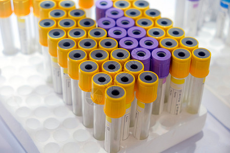 医疗采样管管子化学品医生测试样本紫色肝素诊断贮存科学图片