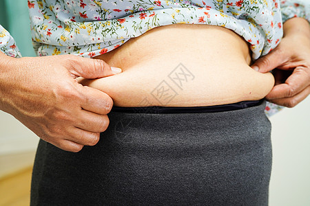 超重的亚裔女性用手挤压胖肚子 大体积超重和肥胖症治疗肌肉腹部外科塑料尺寸工人办公室烧伤成人图片