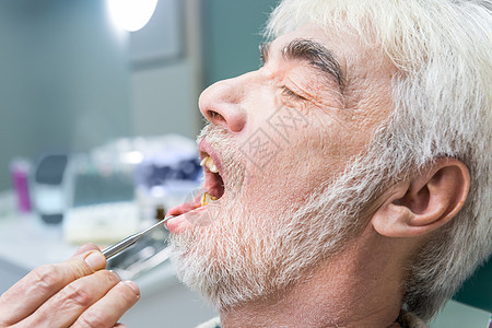 老年男性在口腔科医生图片
