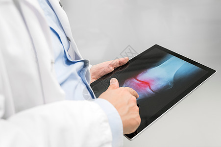 面目全非的医生正在检查平板电脑上的 X 光图像 特写 医生在医院工作 医学和保健概念专家医师治疗x光技术药片疾病职业x射线诊断图片