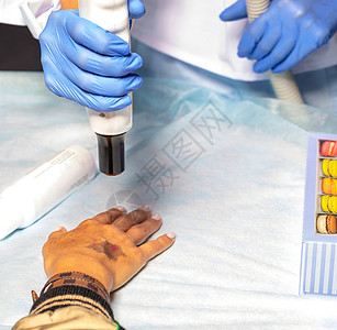 救治伤员一名皮肤科医生使用激光医疗装置清洗病人手臂上的皮肤 在外皮部进行化验时 请携带抗体外伤员检查背景