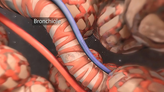 支气管是风管的延伸 将空气输送到肺部视频哮喘呼吸系统肺科气肿呼吸道解剖学生理气管肺炎图片
