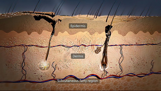 皮肤发炎和肿胀痛苦细胞身体晒斑肌肉科学起源静脉神经颜料图片