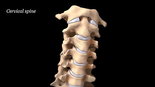 有神经根的人类脊椎脊柱脊髓骨干外科整脊疗法药品诊断运河手术图片