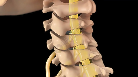 子宫颈脊椎的解剖视图 以及间脊椎结膜抑制神经根骨折疝气药品整脊身体创伤骨骼外科压力疾病扫描图片