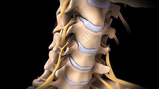有神经根的人类脊椎骨干整脊脊髓椎间症状骨科疾病运河绳索诊断图片