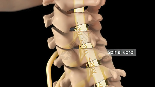 子宫颈脊椎的解剖视图 以及间脊椎结膜抑制神经根骨折神经骨骼骨科药品身体椎骨创伤诊断疗法脊柱图片