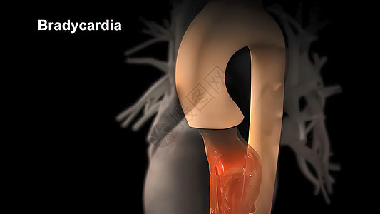 心肌膜心动异常缓慢的心脏动作节奏人体器官抽水心电图测量频率韵律监视器环形图片