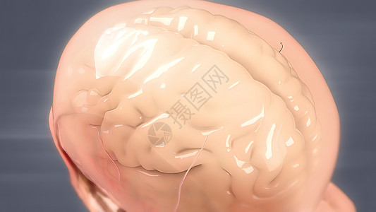 人类大脑解解剖模型3D血管疾病卫生神经系统交通血液障碍出血药品流量图片