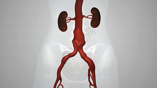 静脉有螺纹的气球血管成形程序镜头导管流动屏幕心脏病学干涉金属血小板支架中风图片