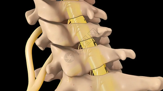 子宫颈脊椎的解剖视图 以及间脊椎结膜抑制神经根骨折疼痛脊柱整脊药品压力身体疝气手术疗法骨干图片
