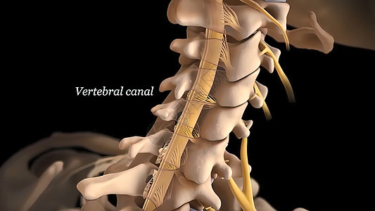 有神经根的人类脊椎药品疼痛诊断光盘创伤外科柱子压力疝气骨骼图片