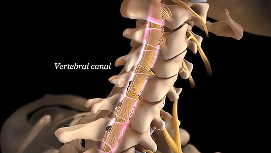 有神经根的人类脊椎骨赘脊髓疾病脊柱骨骼绳索疼痛柱子治疗骨干图片