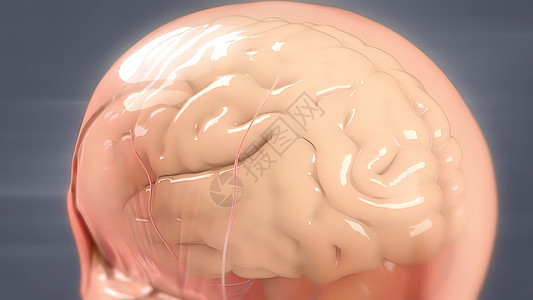 人类大脑解解剖模型3D疾病器官药品供应高血压卫生中脑动脉出血交通图片