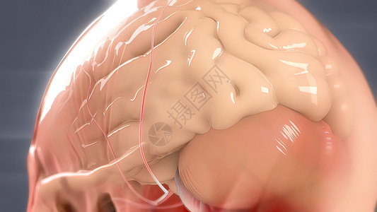 人类大脑解解剖模型3D器官保健障碍交通疾病药品高血压基底并发症血液图片