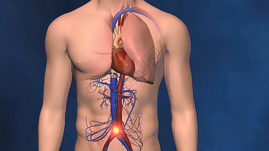 血凝块视其位置和严重性而定 可能危及生命横截面红细胞解剖学动脉科学微生物学静脉压力血栓生物学图片
