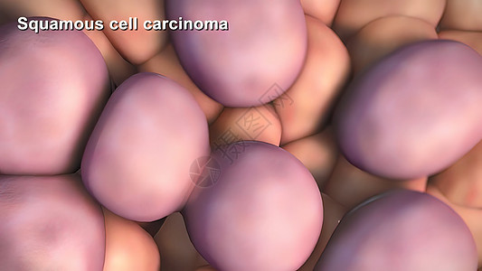 癌症细胞的分裂和生长间期损害文化冒号组织癌细胞生活研究遗传疾病图片