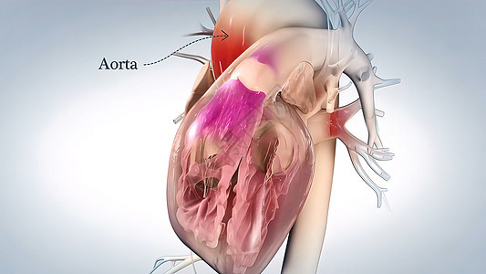 心脏的Aorta 血液从心脏流出 人类心解剖解剖学主动脉胸部心脏病学静脉生活男性心室骨骼心悸图片