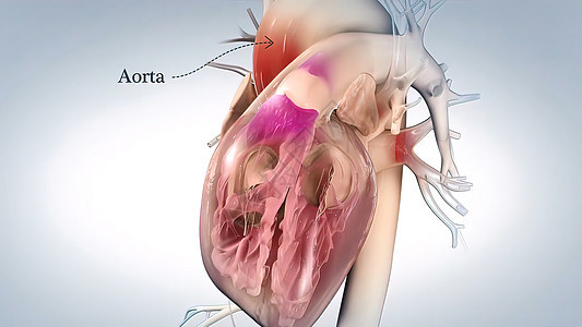 心脏的Aorta 血液从心脏流出 人类心解剖心律失常高血压心血管静脉心脏病心室压力生活心脏病学渲染图片