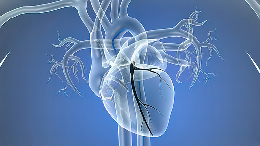 插入一个支节打开隐蔽的动脉外科药品心肌疼痛心脏病学血管显微镜手术情况诊断图片