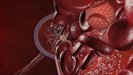 身体内胆固醇导致血管隔绝循环实验室红细胞黄疸微生物学死亡贫血生物血浆细胞质图片