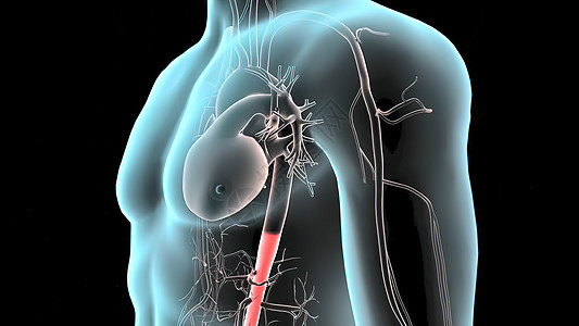 3D 脉搏剖腹膜动脉瘤医学插图粗肠杯子大肠呼吸冒号腹部胰岛素身体糖尿病糖病图片