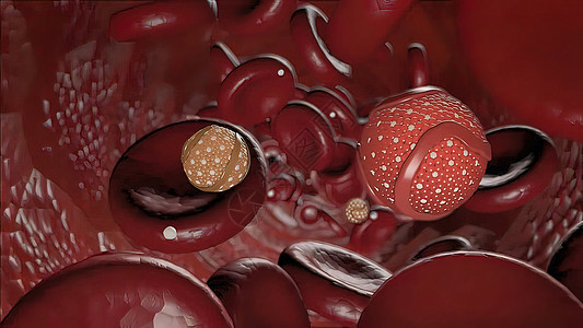 冠状硬化 胆固醇和其他物质 在动脉壁上凝块细胞解剖学生物活性化学运动疾病心血管脑血管图片