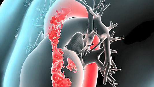 3D 脉搏剖腹膜动脉瘤医学插图呼吸器官身体冒号腹部杯子胰岛素糖病肋骨心碎图片